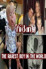 Watch Aidan The Rarest Boy In The World Zmovies