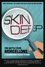 Watch Skin Deep: The Battle Over Morgellons Zmovies