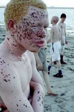 Watch Albino United Zmovies