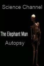 Watch Science Channel Elephant Man Autopsy Zmovies