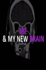 Watch Me & My New Brain Zmovies
