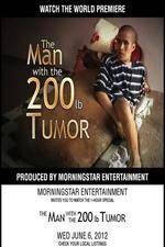 Watch The Man With The 200lb Tumor Zmovies