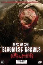 Watch TNA Wrestling: Best of the Bloodiest Brawls - Scars and Stitches Zmovies
