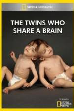 Watch National Geographic The Twins Who Share A Brain Zmovies