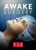 Watch Awake Surgery Zmovies